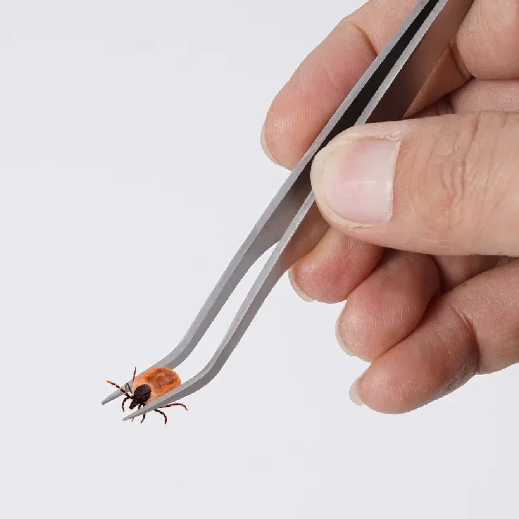 Professional 2-in-1 Flea & Tick Removal Tweezers